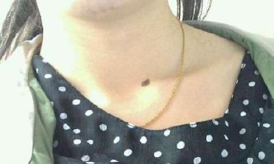 女人脖子有痣暗示什么:女人痣相图解大全