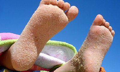 脚底长痣好不好