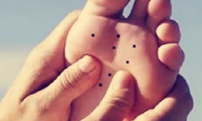 脚底有痣代表什么意思,脚踏七星确实是好命之人