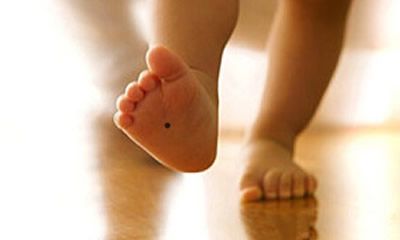 解读分析脚掌心有痣好不好