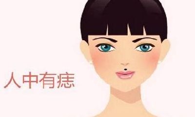 女人中有痣影响好不好