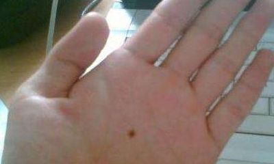 身上的朱砂痣是什么含义