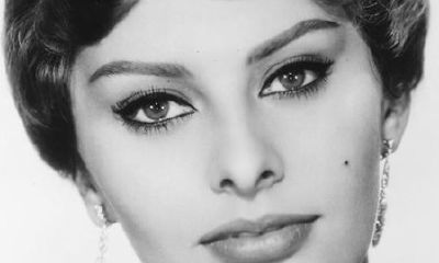 美人痣图片大全