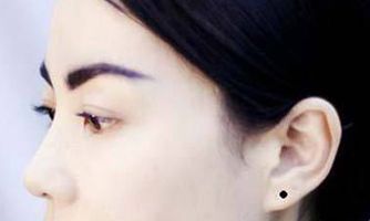 左耳垂有痣命理解析