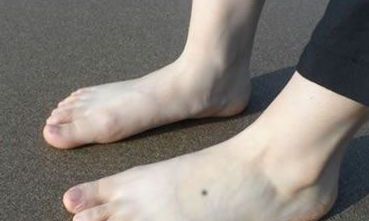 男人脚底痣相图解大全 脚底痣相分析