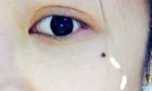 脸上七星痣预示什么