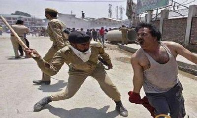 梦见儿子不懂事,我经验教训他,不经意中把他的肉扭流血了。