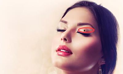 长在眼睛周围的痣都有哪些属于恶痣