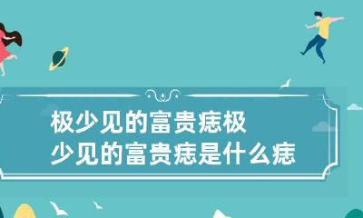 极少见的富贵痣 极少见的富贵痣是什么痣