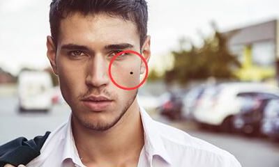 擅长赚钱的人面部有哪些特殊痣相