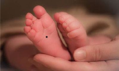 脚底有痣好不好 哪里的痣更有福气