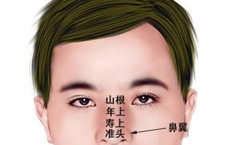 男人鼻子痣相图解大全