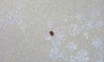 梦到有许多体内湿气虫