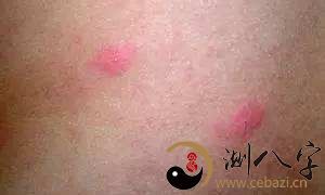 梦到自己被虫咬