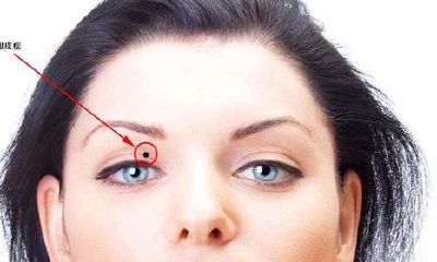 男人左眼皮上有痣好不好