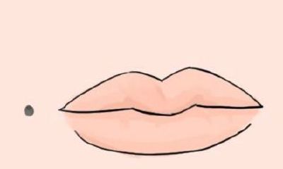 脸上哪个地方长痣需要晚婚?哪个地方长痣注意是非?