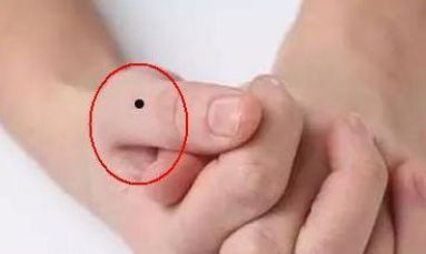 这个位置的痣,大多都是福痣,多寿多金,越老越有福