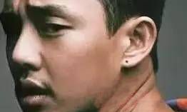 耳朵有痣即为福相 男性痣相解析