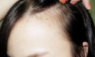 女人脸上的痣看旺夫运的好坏,脸上这四颗痣,你有吗