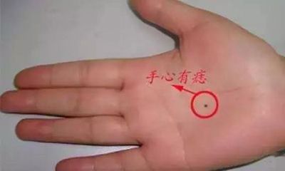 风水痣相有吉凶,何处有痣有富贵