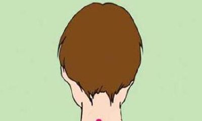 女人脖子上有痣好不好