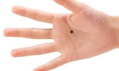 手心有痣的手相图解