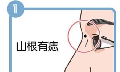 4种在鼻子上的痣,哪种代表了事业有成
