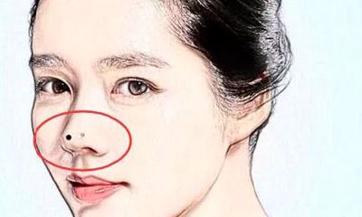 贵人痣,脸上四处长吉痣,中奖几率高,事业有人帮