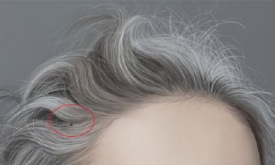 身上隐痣中的四大吉痣