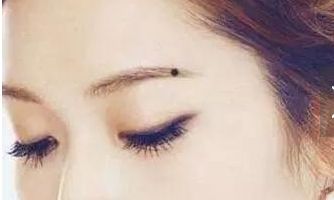 上佳的显痣、隐痣有哪些