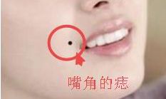 身上这几个地方有痣的,好还是坏
