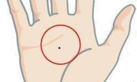 吉人自有好痣相,身上3处长痣一生富贵跑不了