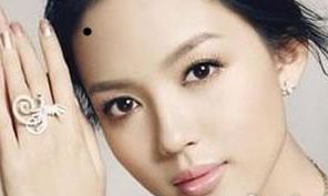 「痣中极品」,这几处痣相能给你带来福运