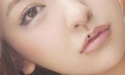 几个部位长的痣代表福气,你的是吉痣吗