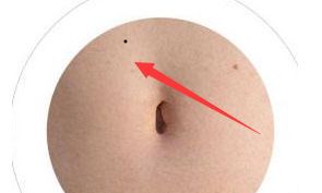 女人肚脐周围痣,富贵夫婿痣,旺口痣,桃花旺,嫁夫旺财