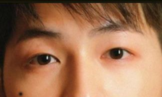 痣相看人生富贵 最招财运的痣长在哪里