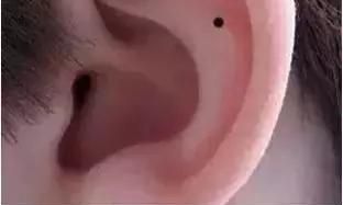 哪些部位有痣代表「房产多」