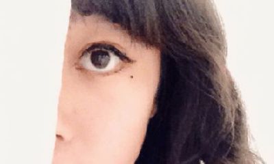 我们脸上的痣哪些是善, 哪些则为恶痣呢