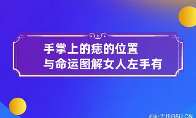 手掌上的痣的位置与命运图解 女人左手有痣全图解