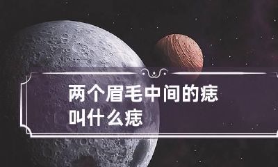 两个眉毛中间的痣叫什么痣