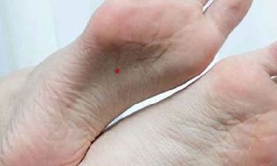 男生脚底朱砂痣好吗,代表什么?