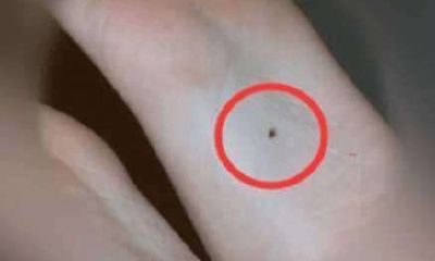 男人左脚下有痣好不好_左脚有痣的含义