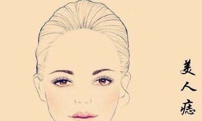 解析美人痣都长在什么部位