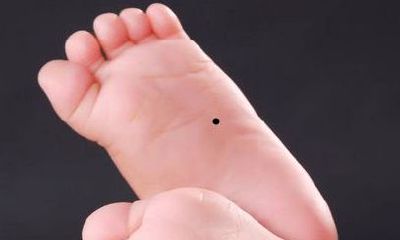 脚底有痣有什么不好 代表什么意思