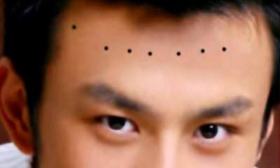 揭秘男人额头有痣的人到底好不好