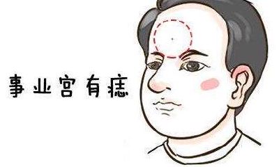 男人有福气的痣一般长在哪里?