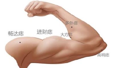 痣相分析:男手臂痣的位置与命运图