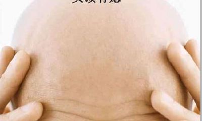 十种最有福气的痣 你身上有几处