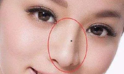 女人面部痣相分析 女人面部痣相解读