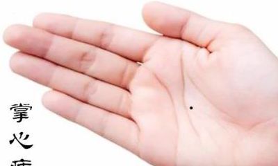 女人手心痣相图解 女人手心痣相好不好